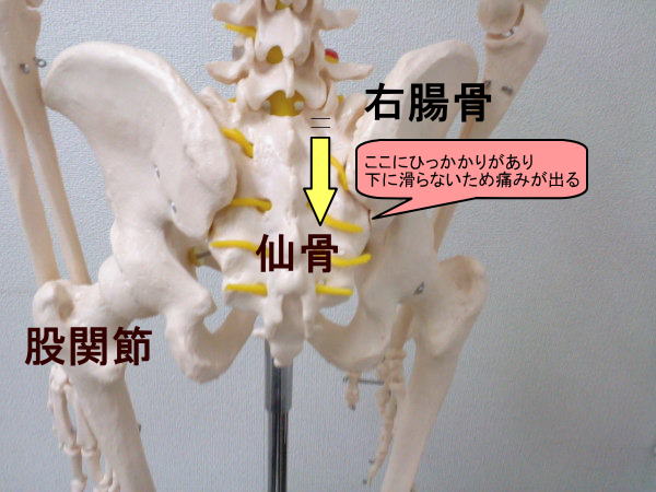 骨盤の画像6.jpg