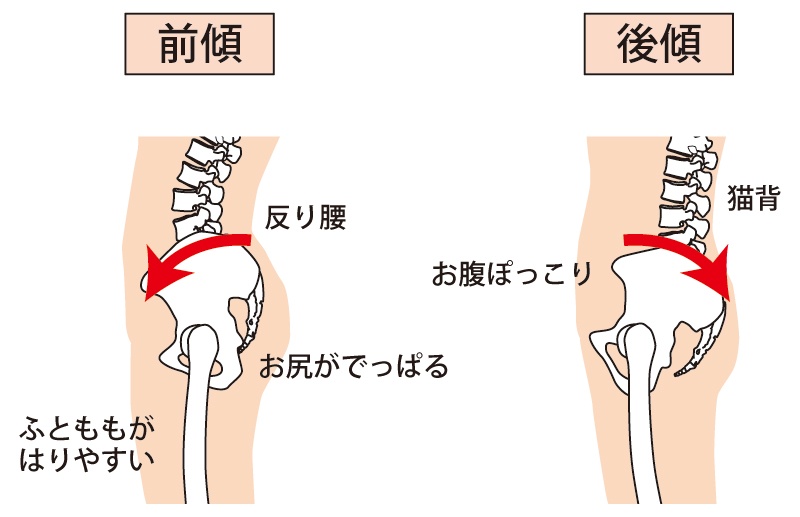 デスクワークで椅子に浅く腰掛け、骨盤後傾(後ろに倒れる歪み)を起こすことで腰痛や肩こりを引き起こす仕組みのイラスト