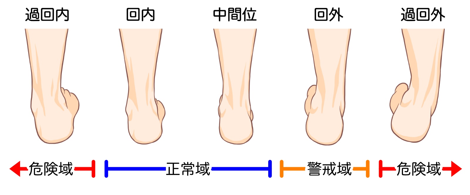 足首過回内のイラスト