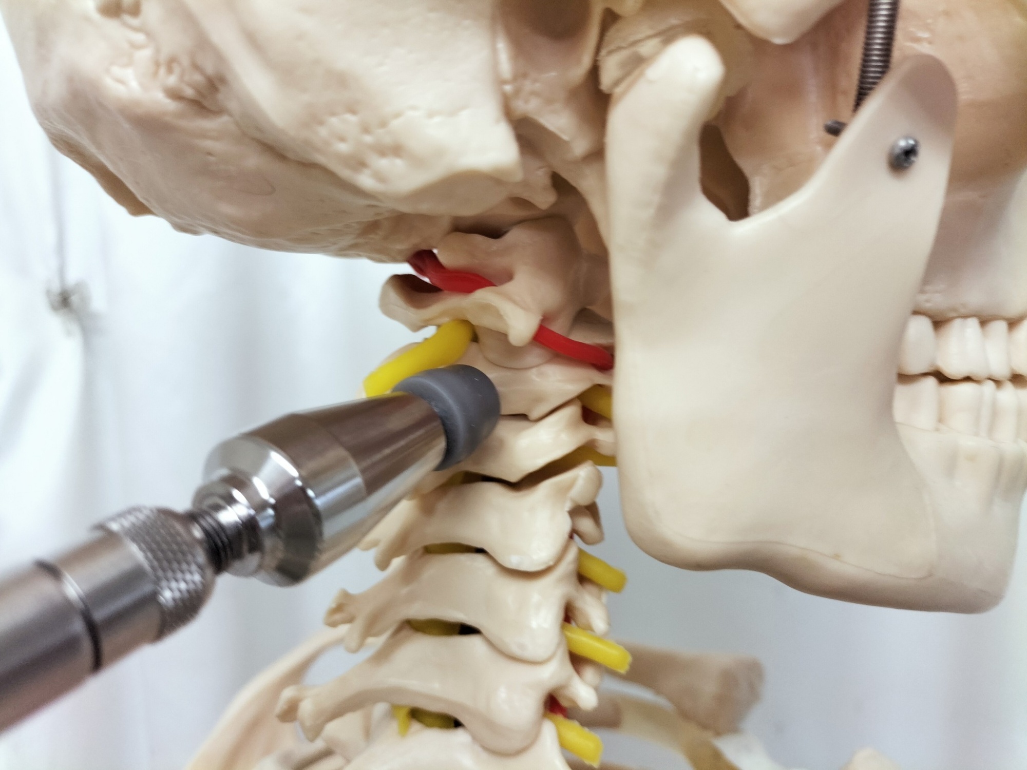 アクティベーターによる頸椎２番んの矯正