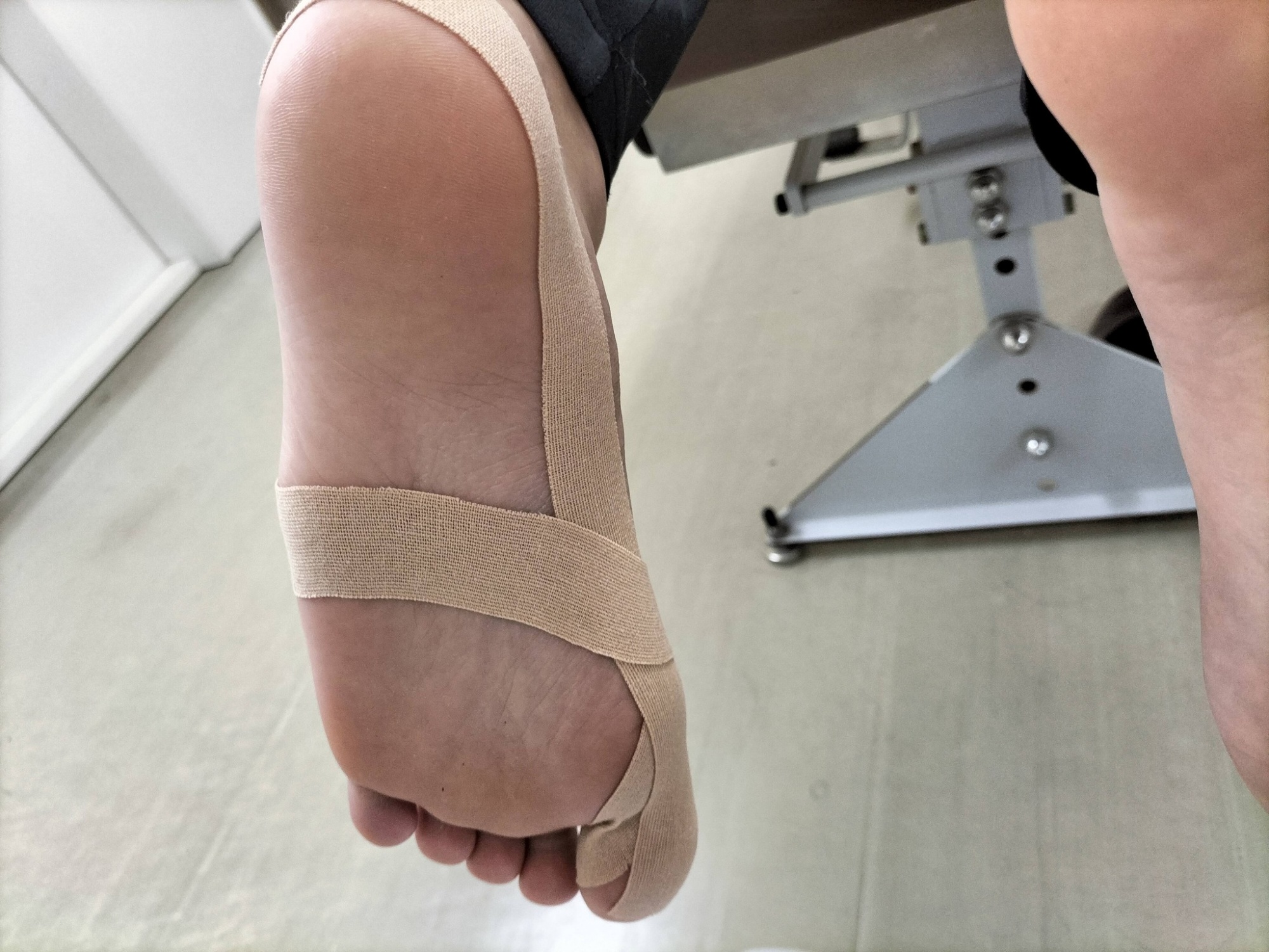 外反母趾のテーピング