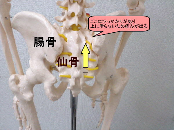 骨盤の画像2.jpg