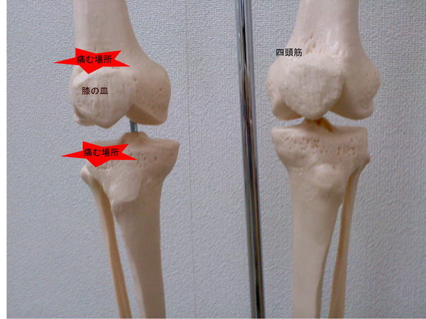 膝の痛む場所の写真１.jpg