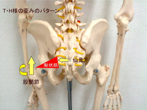 T・H様のお尻の痛む場所2.jpg