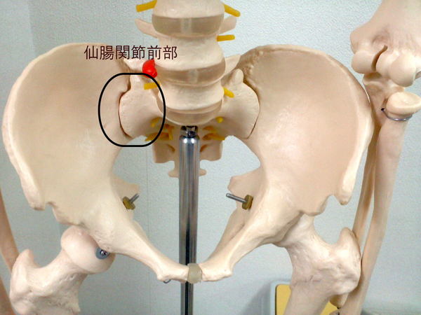 M・O様の股関節の痛み画像2.jpg