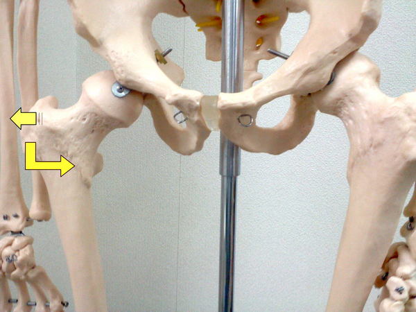 M・O様の股関節の痛み画像5.jpg