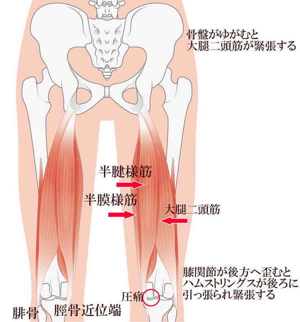 ハムストリングスの痛みと膝の関係.jpg