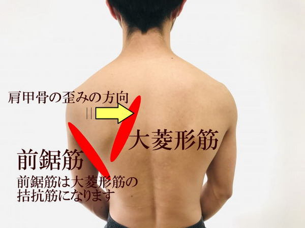 左 肩甲骨 内側 痛み 2.jpg